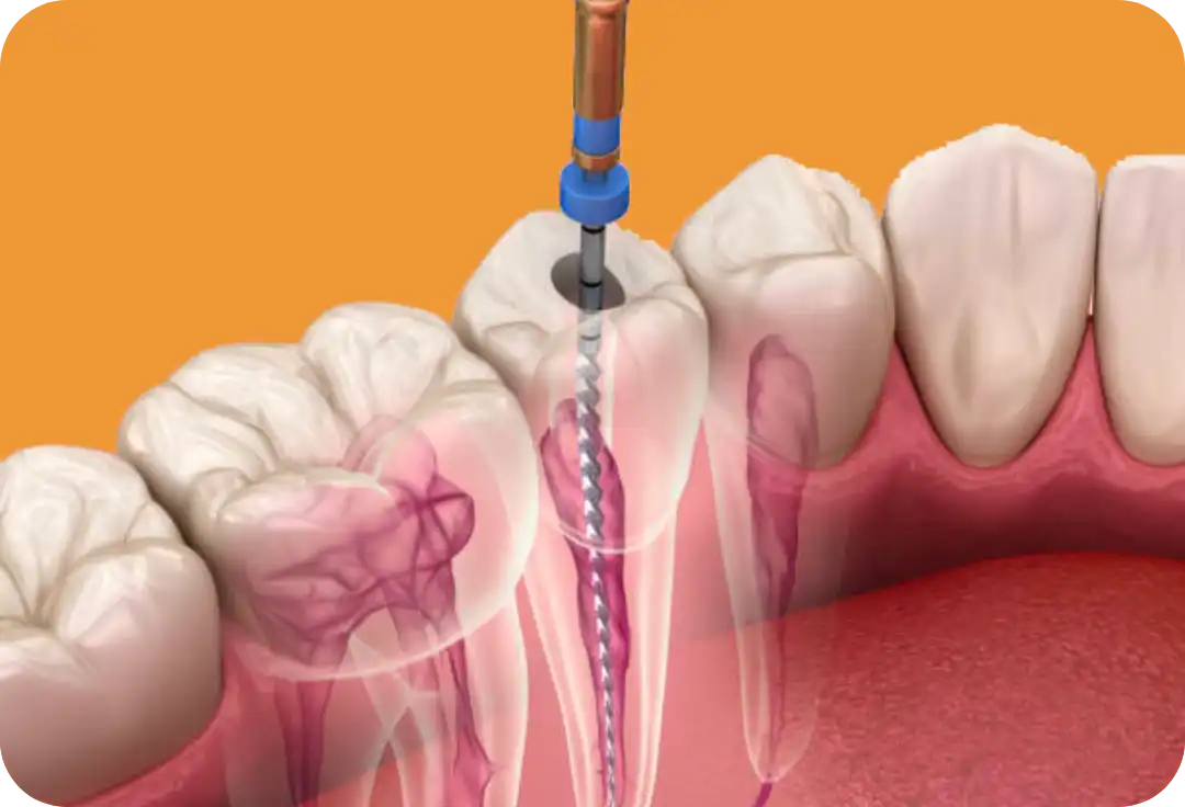 dolore-denti-studio-dentistico-miggiano-rivetti-prato-sesia-novara