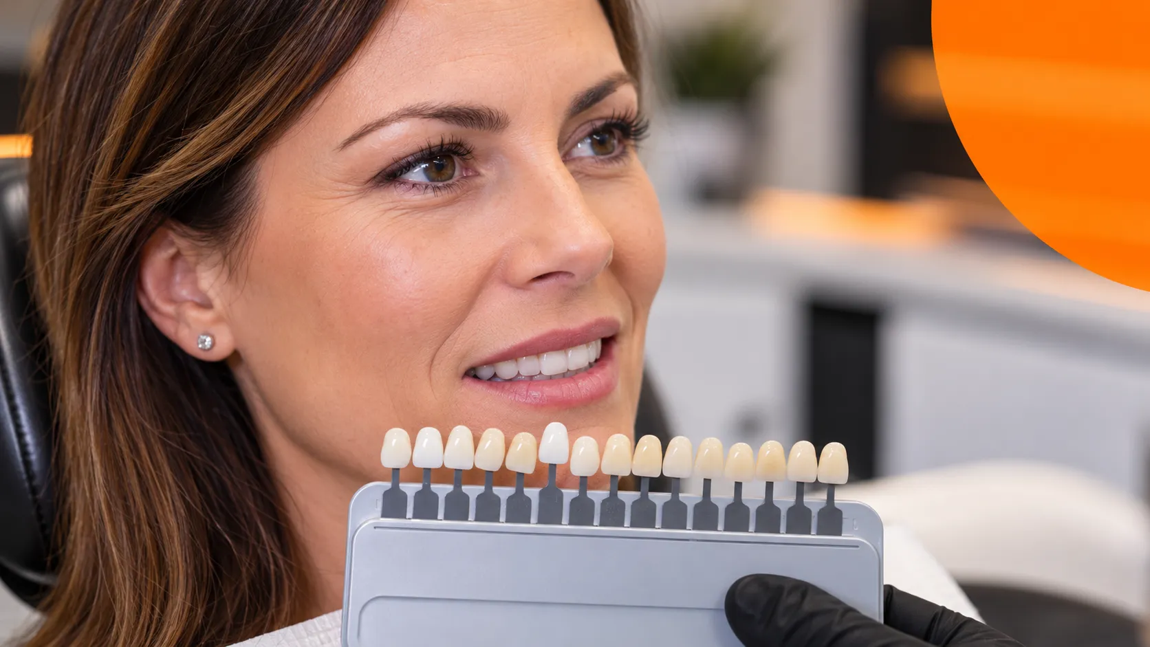 controindicazioni-faccette-dentali Valutazione del colore delle faccette dentali allo Studio Miggiano Rivetti